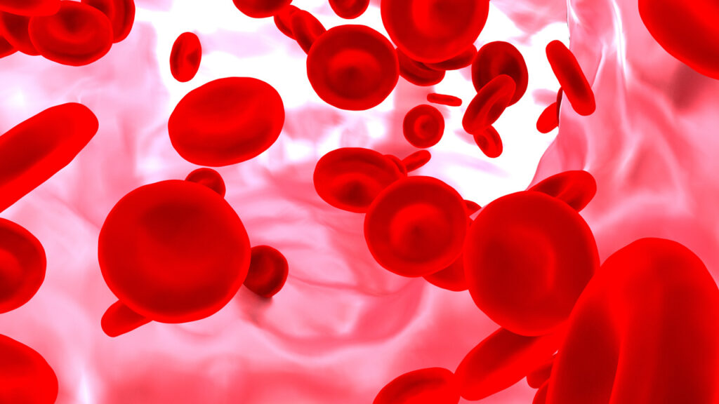 โรคโลหิตจาง (Anemia) คืออะไร อาการ สาเหตุ ควรกินอะไร